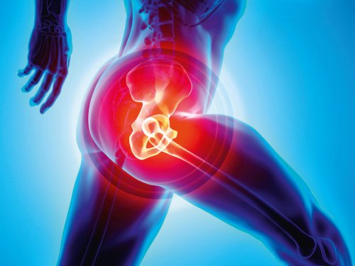 thecsp's tweet photo. Hip replacement surgery for the under 60s is becoming more common, but could conservative management be an alternative? REad more: https://t.co/FoX7YZ6jwJ https://t.co/rK5rCykBYg
