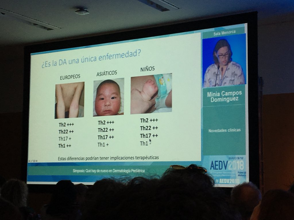 Dermatitis atopica: diferentes poblaciones linfocitarias en función de geografía - misma enfermedad? #AEDV2018 #dermatologia #dermatology