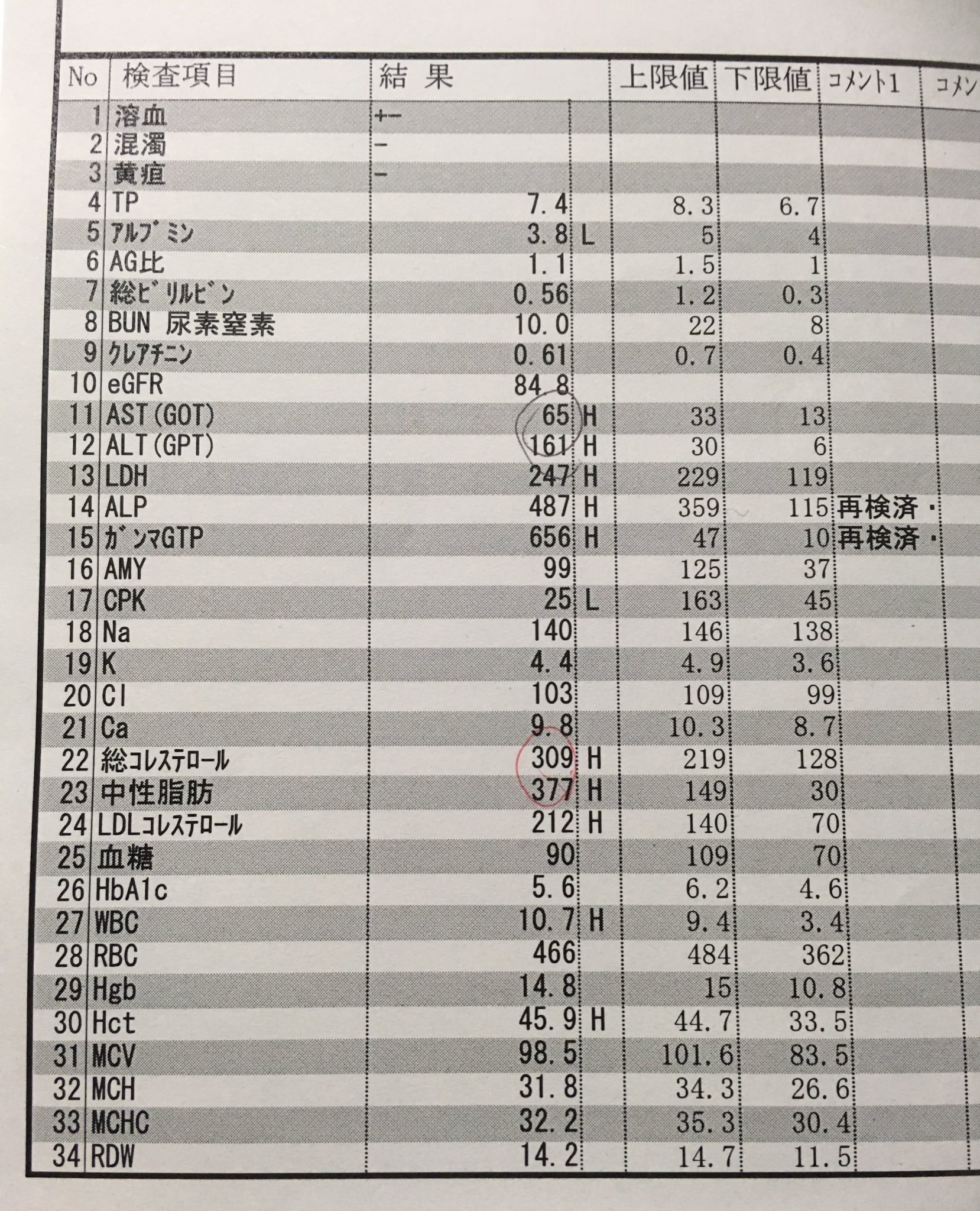 Alp は 機能 肝 と