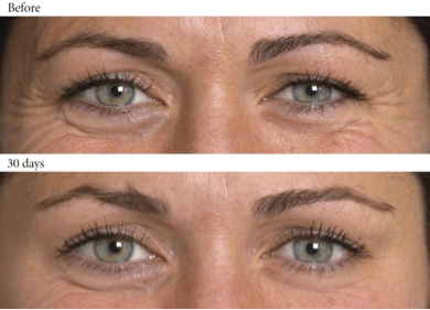 HealingBeautyC's tweet photo. Take advantage of our #botox special tomorrow. One day only, SAVE $200! Book today. 
519-653-1991 reception@healingbeautyclinic.com

#botox #dysport #lipinjections #beauty #wrinkles #finelines #you #wrawesome #kwawesome #cbridge #save #deal https://t.co/pyiCgeDYWw
