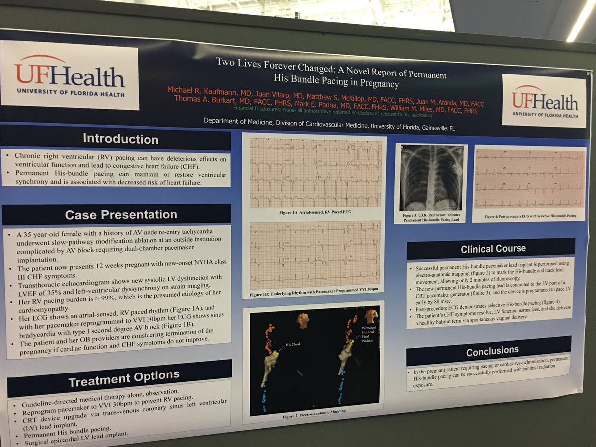 drpmoskal's tweet photo. His bundle pacing during pregnancy - surprising case at poster session. #HRS2018 #dontdisthehis https://t.co/t5OkxXX0JN