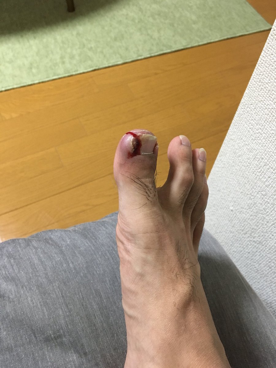 民族主義 パール 骨の折れる 巻き 爪 靴下 Cest Chouette Jp 民族主義 パール 骨の折れる 巻き 爪 靴下 Cest Chouette Jp