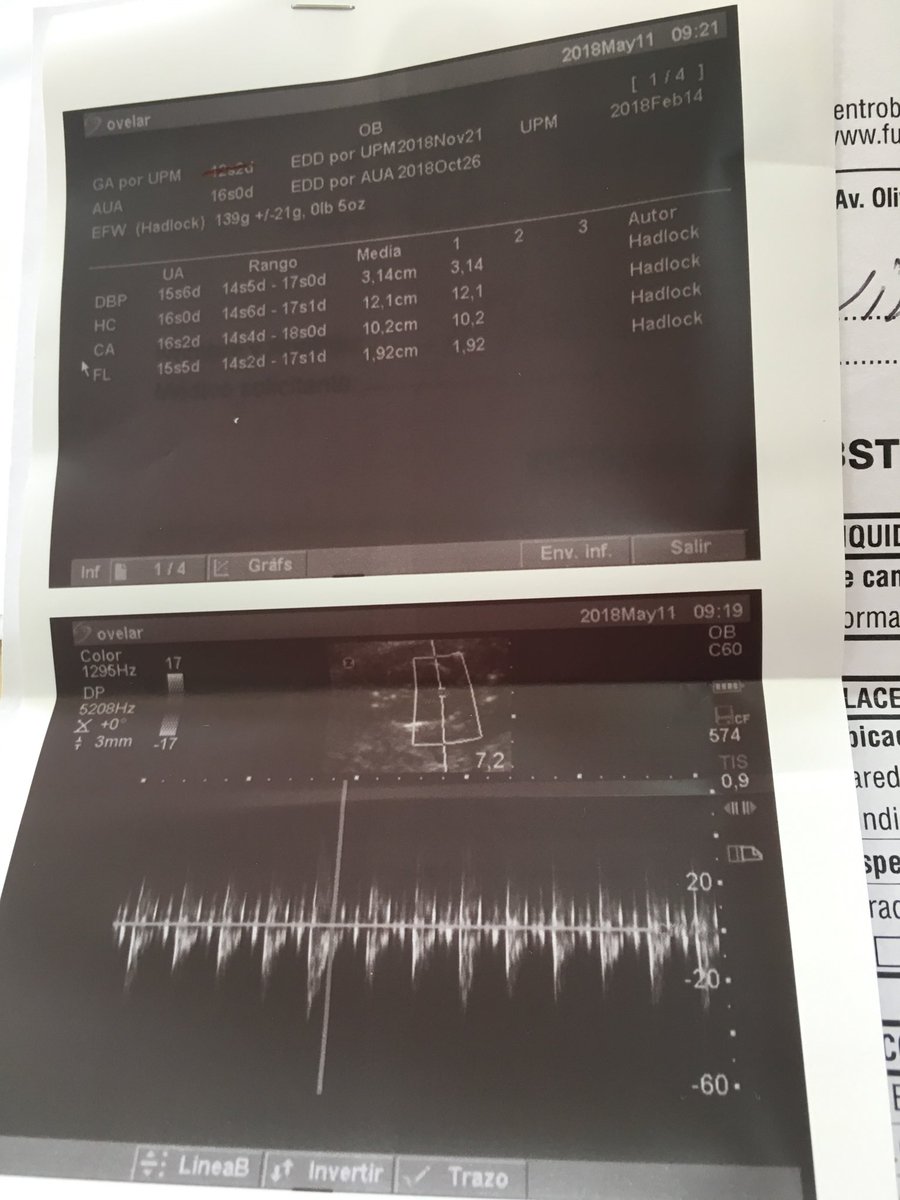 Que lindo fue escuchar el corazoncito de mi hijo...