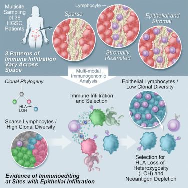 mmw_lmw's tweet photo. Immune #ClonalDynamics shapes #Malignant Cell Evolutionary Trajectories: in Ovarian cancer | SohrabShah @UBC @CellCellPress https://t.co/FdxinA9CQ5 https://t.co/gq6VdT5cY1