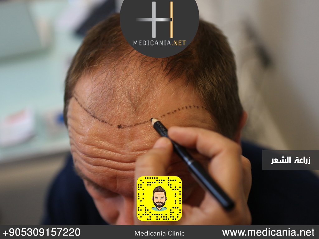 HamzeHamode's tweet image. 