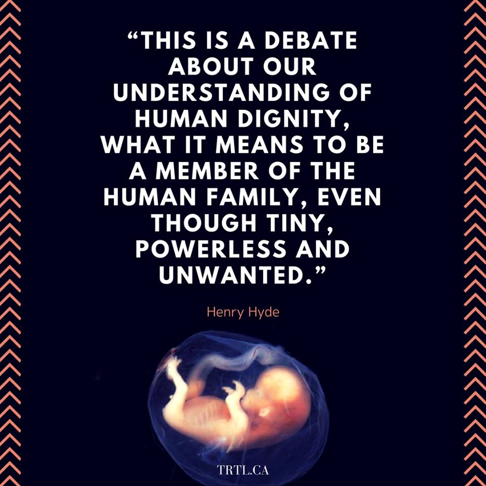utsfl's tweet photo. Human life needs protection! Human dignity starts at conception!
#LoveTheBoth #FightForLife #ProLife https://t.co/Gltik91QBC