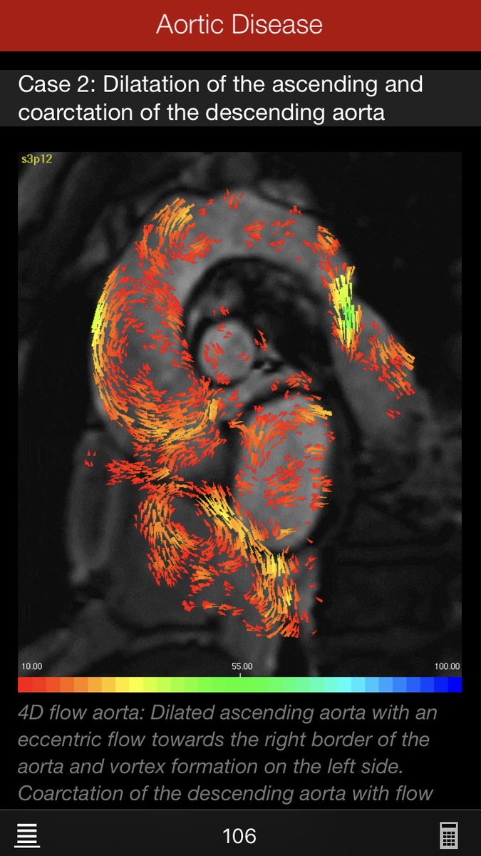 alxbenevides's tweet photo. #CMRguide App: I deeply recommend! Have u ever known?@rahatheart1 @EM_RESUS @SamRRazaMD @iamritu @rosencher @AnastasiaSMihai @DrKristieLeong @lipiddoc @DrKhouryCDC @sjauhar @DrJennHaythe @DrShawnGroth @DrEricLevi @drmlb @Dr_Beale_ @SABOURETCardio @CardioIAN 
#MR #CardioTwitter https://t.co/lN3xPegFA8