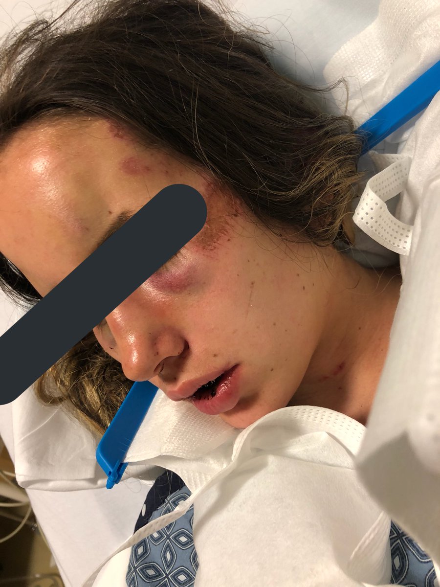 If you are from the IE , near Colton , Redlands , or Highland area keep a look out for this man. There is a felony warrant out for his arrest and this isn’t the first time he has laid hands on a girl. Domestic violence is REAL ladies please be careful.. Please RT till we find him