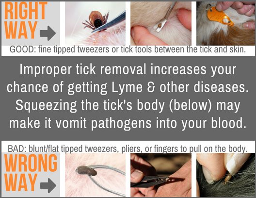 How to remove a tick correctly. No twisters, fire, smothering, etc
#LymeDisease #ticks #lymeawareness