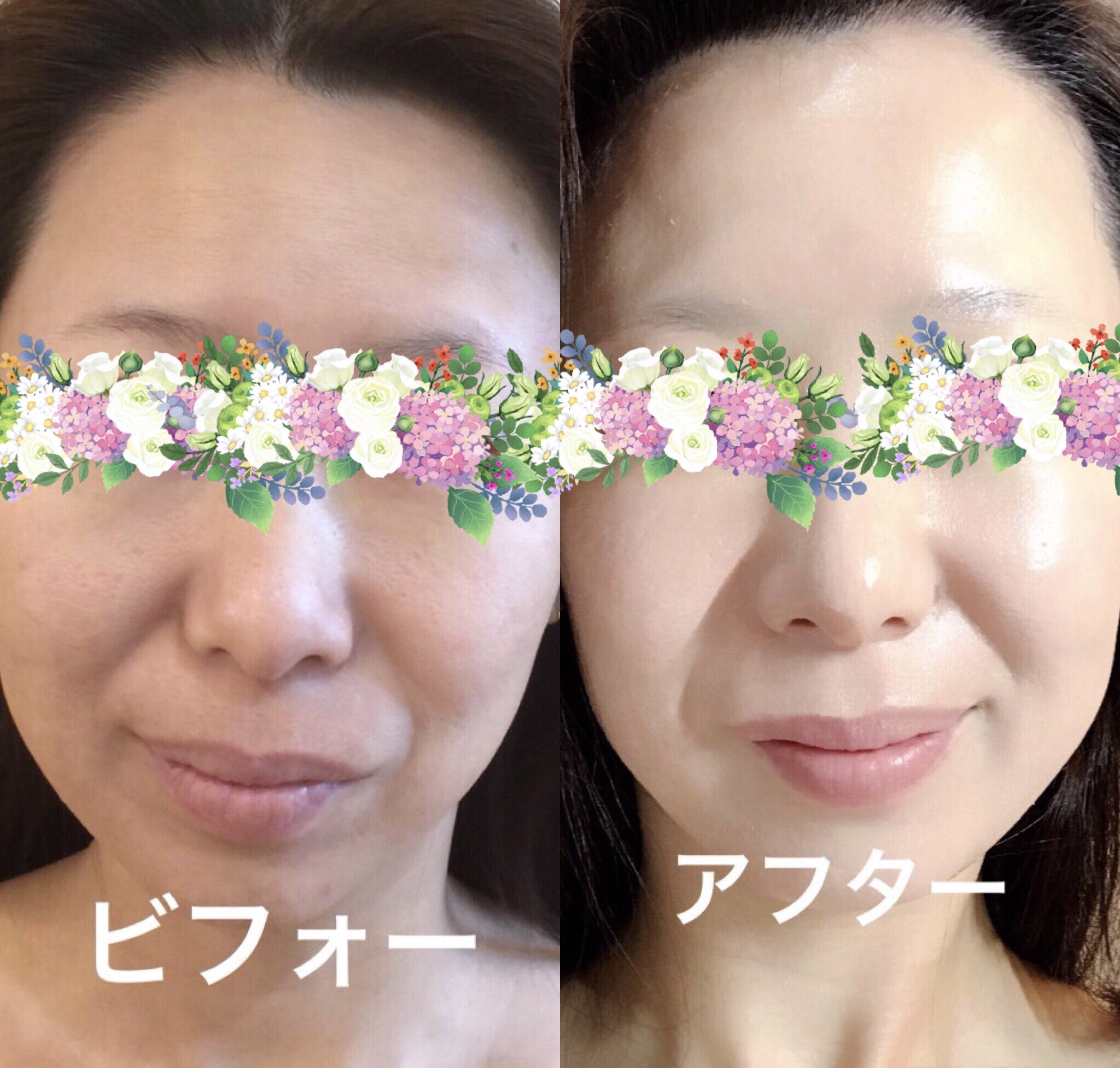 最新発見 ボタニカルピール レベル7 fawe.org