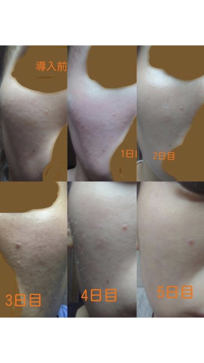 Botanical Peel (@BotanicalPeel) / X
