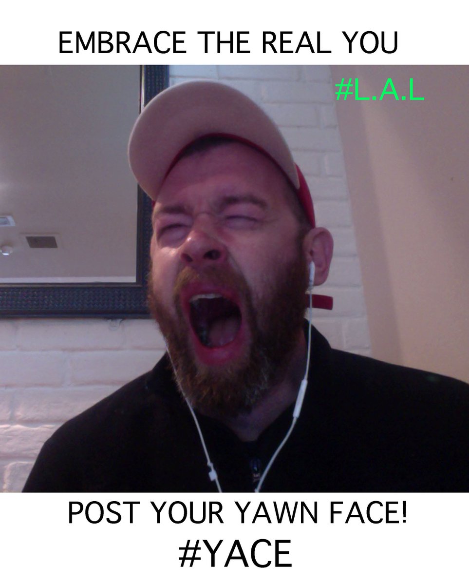 Lifeatlargeme's tweet image. its a real positive craze guys get involved!
#yace #yawnface #queer #lal #therapeasy