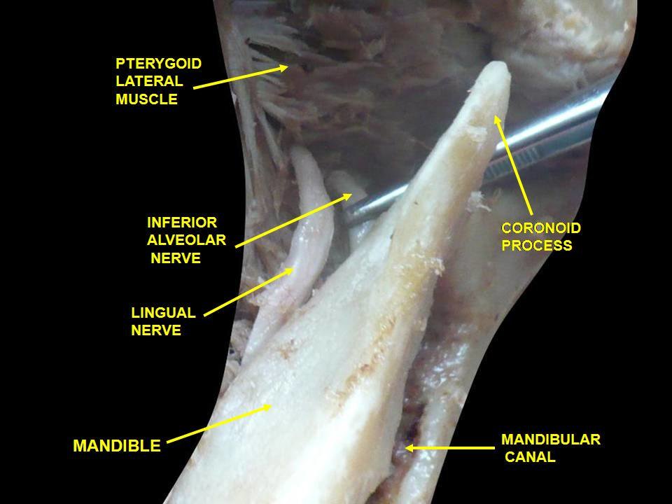Dental_Buzz's tweet photo. Anatomy : Inferior Alveolar nerve &amp; related structures.
#anatomy #dentist #dentistry #odontologia #dentalstudents https://t.co/QK6MMzopTZ