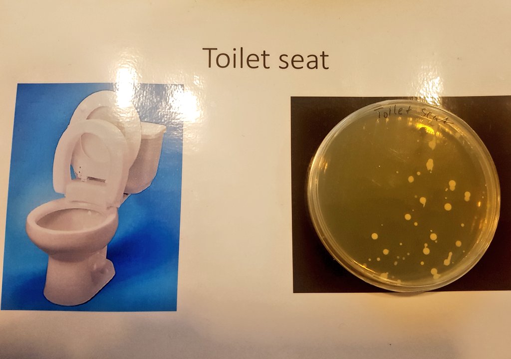 TheZwitterion's tweet photo. Confirming something I think I already suspected, that the tube is dirtier than a toilet seat! Also a study found 9 antibiotic resistant bugs on the UG last year!
https://t.co/QsaFupaK0h
#superbug #impfest #washyourhands #AntibioticResistance #superbugzone @Independent https://t.co/yoe35i0Vnc