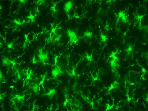 alphalabs's tweet photo. Rabbit #Anti-Iba1 #antibody Specific to #microglia and macrophage, does not cross-react
with neuron & astrocyte. Reactive with human, mouse and rat #Iba1 for #research #immunhistochemistry #immunocytochemistry see fluorescent staining in rat #brain
https://t.co/9hCSgQbXfv https://t.co/0Fu6VuuJVF