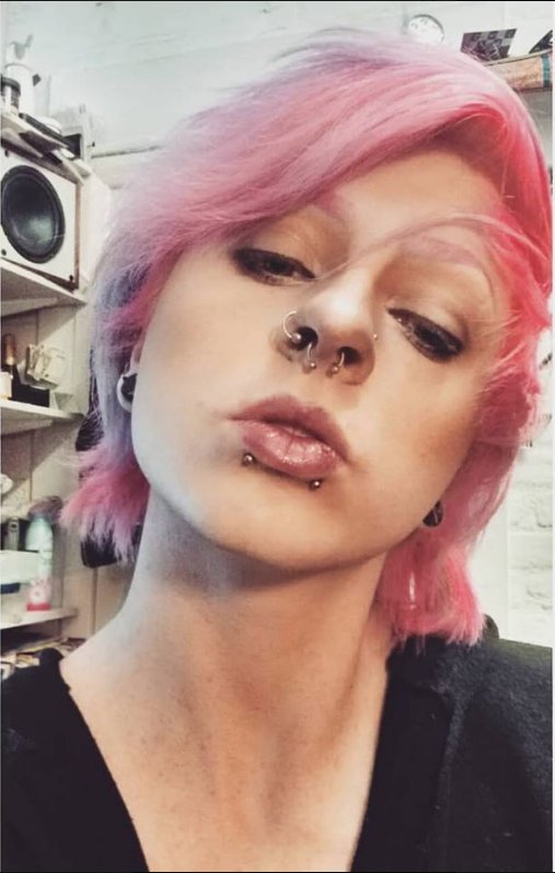occulttrash's tweet image. Ngl I am gonna miss these lips when the swelling goes down 💋💎💎
#Snakebites #Newpiercings
