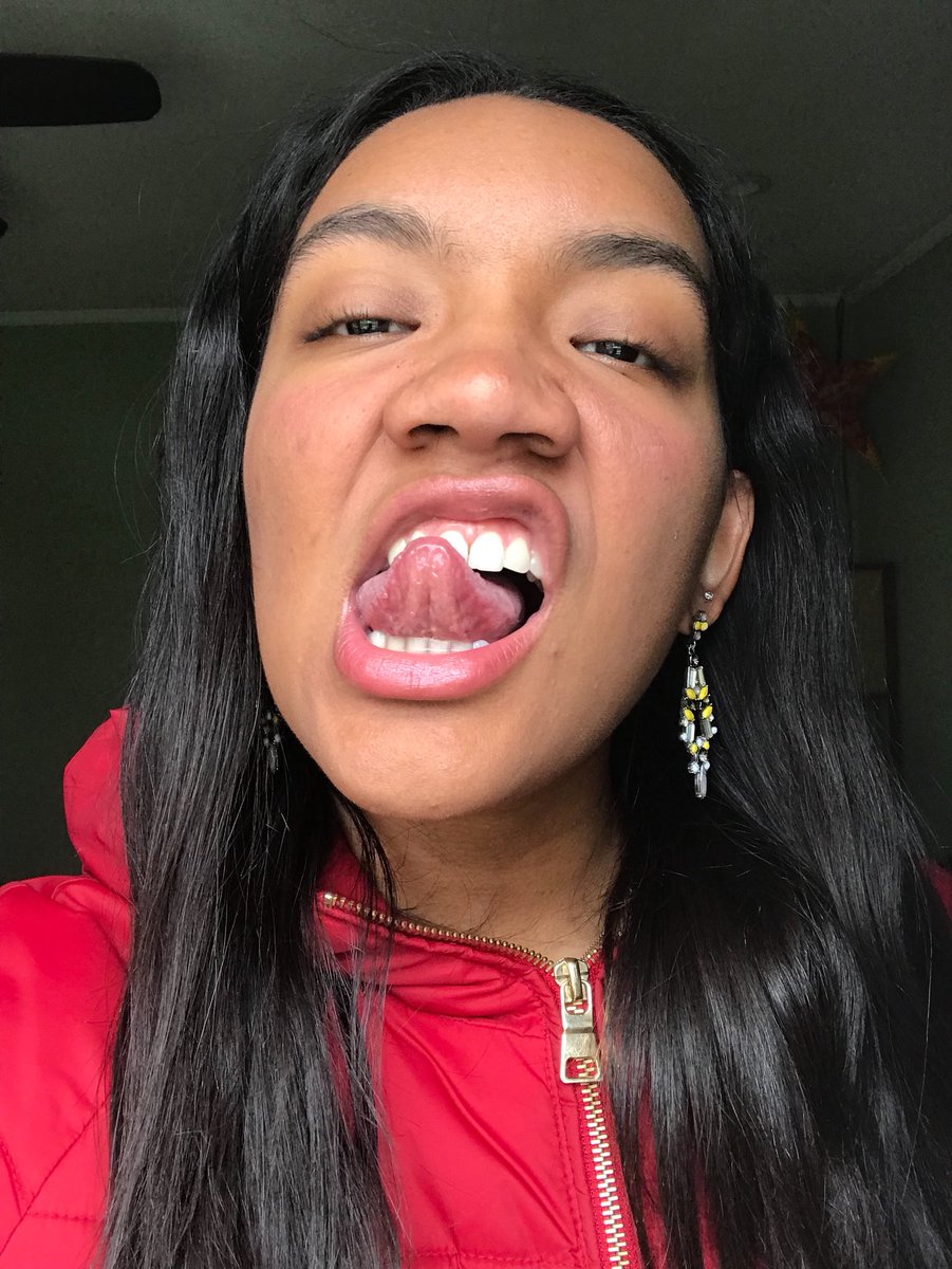 shiannarodas's tweet photo. @glossier you make me need no filta #cloudpaint #balmdotcalm #wowder https://t.co/jPhEHoYfdY