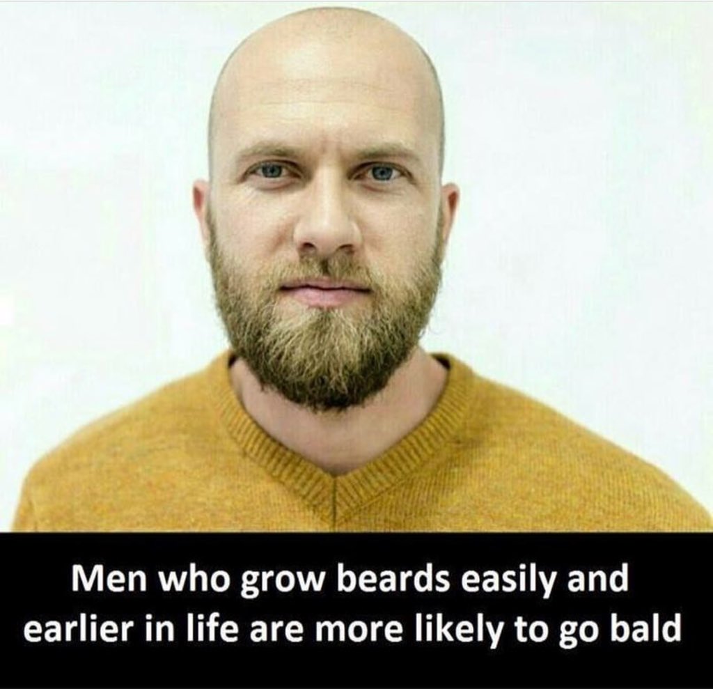 LoveMeStyles99's tweet photo. Well.. You are never gonna go bald. @Harry_Styles https://t.co/hwvMasRLe4