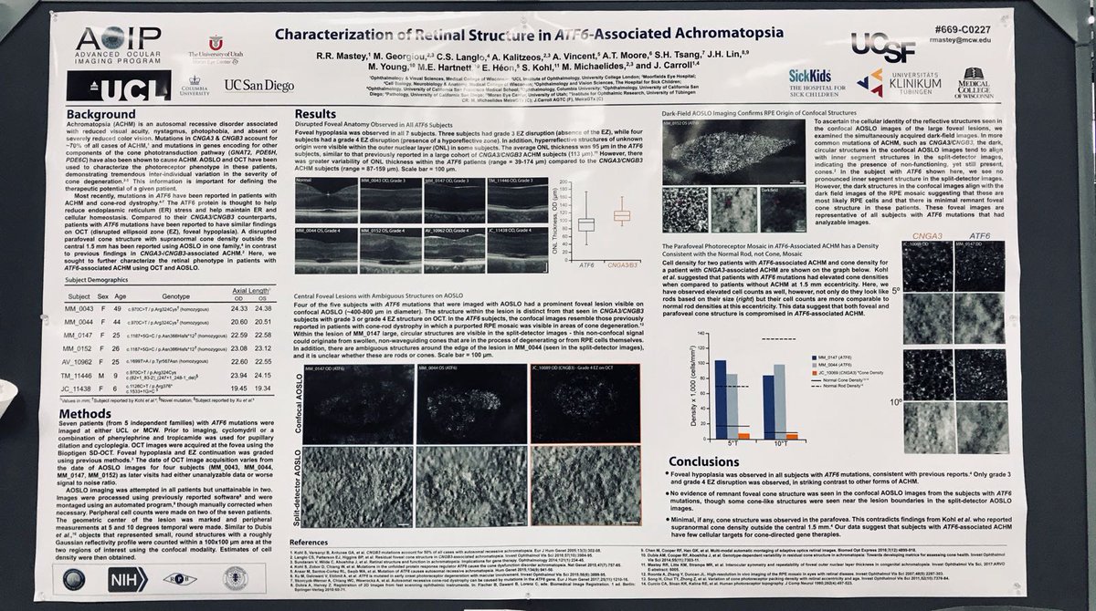 UCL_Retina's tweet photo. Yesterday's #ACHM poster @ARVOinfo presented by Rebbeca Mastey (@AOIPLab) with rare #ATF6 #mutations describing the phenotype on a cellular scale for the first time; contributing many @MoorfieldsBRC patients alongside other international collaborators! #ARVO2018 https://t.co/sUxrf7iM2b