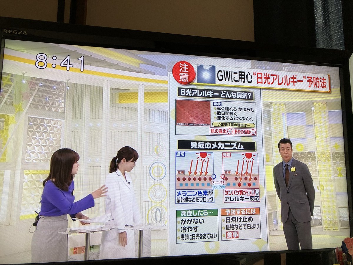 なかちゃん 2y 6m En Twitter 日光アレルギー予防法 予防法 スッキリ