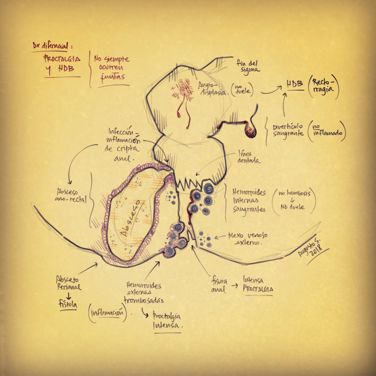 chuletadeosler's tweet photo. Proctalgia y rectorragia, no siempre ocurren juntas. Una revision al diagnostico diferencial #cirugia #urgencias #gastroenterologia #rectorragia #protalgia #medicina https://t.co/DxA13PaVy0