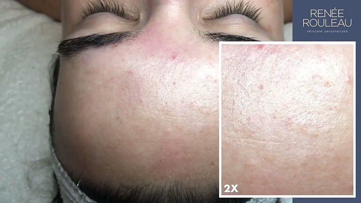 skin addiction reddit