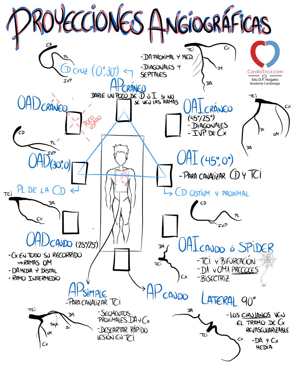 cardioteca's tweet photo. Hemodinámica. En la vida no es fácil orientarse... ¡pues en hemodinámica tampoco!

Una pequeña ayuda con las proyecciones básicas. ¡Ánimo! :D https://t.co/wDSXAIQsPb