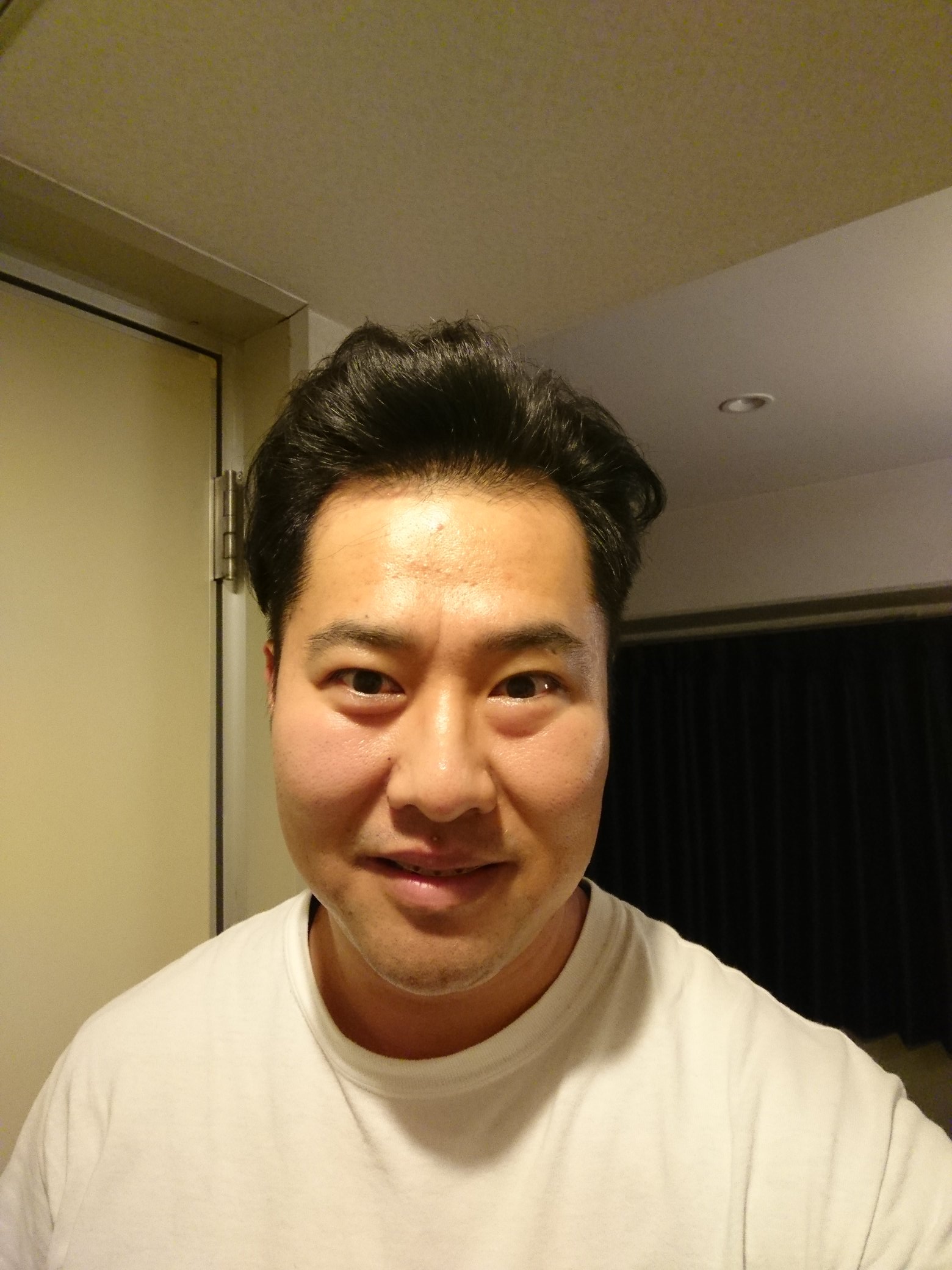 تويتر とにかく明るい安村 على تويتر パーマかけて髪型ブルーノマーズにしてもらったよ 毛量少し足りなかったよ T Co 0zmdzmanmu