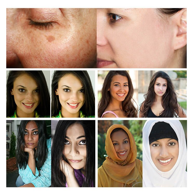 bgtrs.pro/?target=-7EA5Q…  Les Français éclaircissent leur peau de 5 tons en 14 jours seulement: Impossible de croire une telle transformation!