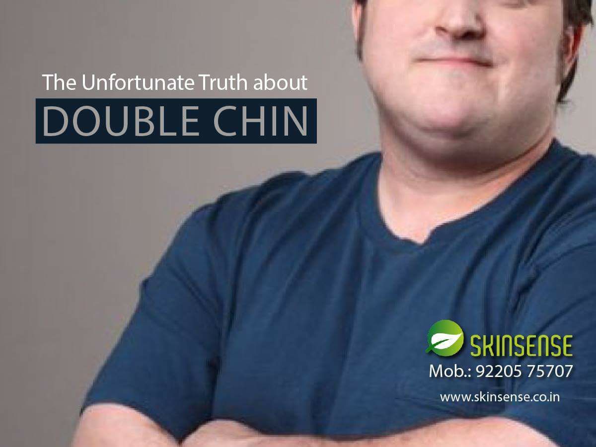 Do you know the #UNfortunate Truth about DOUBLE CHIN?
A double chin, is a common condition that occurs when a layer of fat forms below your chin. If you have double chin and want to get rid of it.
Fill up the form and get rid of your DOUBLE CHIN
buff.ly/2tLBVF8