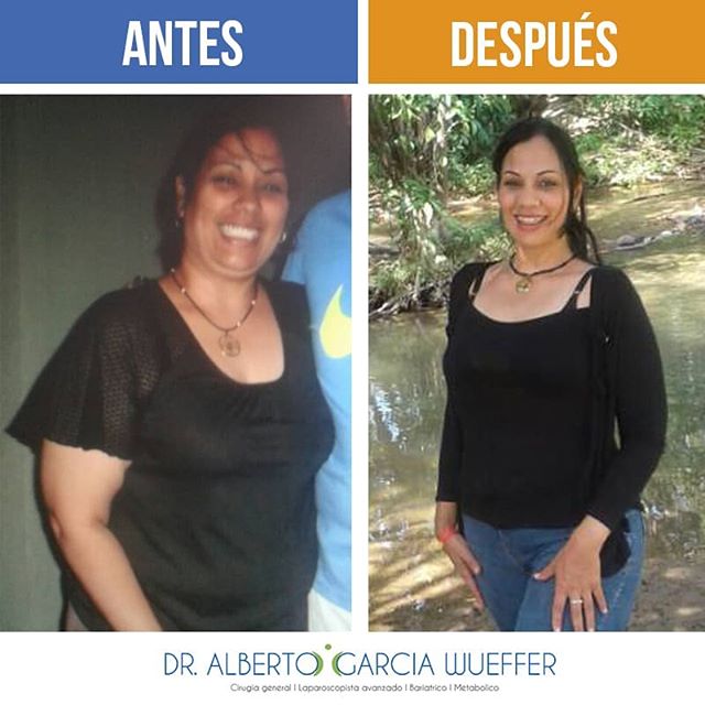 unigastro's tweet photo. Testimonios que satisfacen pacientes que confiaron en el equipo de @unigastro.  Sigue así 👍🏻👍🏻👍🏻 Su felicidad es la nuestra #bariátrica #unigastrodevenezuelatips #unigastrodevenezuela https://t.co/51KOqesXI5