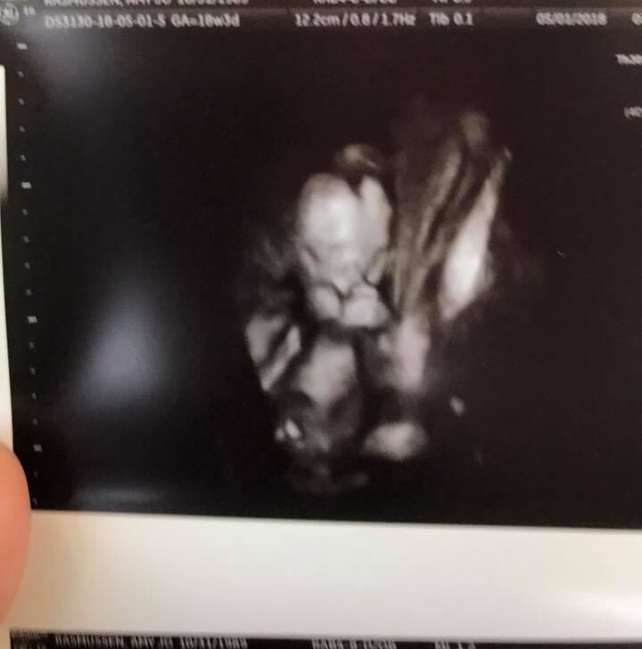 TheRaz2007's tweet photo. I can officially say now that I am going to have a nephew! Sonogram confirmed it today! So excited to be #AuntieRaz in a few months! #HunterThomas https://t.co/3VPNygJaaU