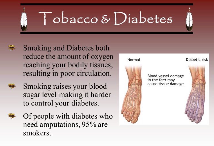 CabunHealth's tweet photo. Tobacco increases the risk for amputation in diabetic patients.  #diabetes #cabunhealth https://t.co/icuewtPd8o