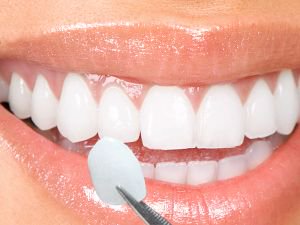 Dental 3D Printer is getting traction ! What to expect in the future? buff.ly/2Fwg31m