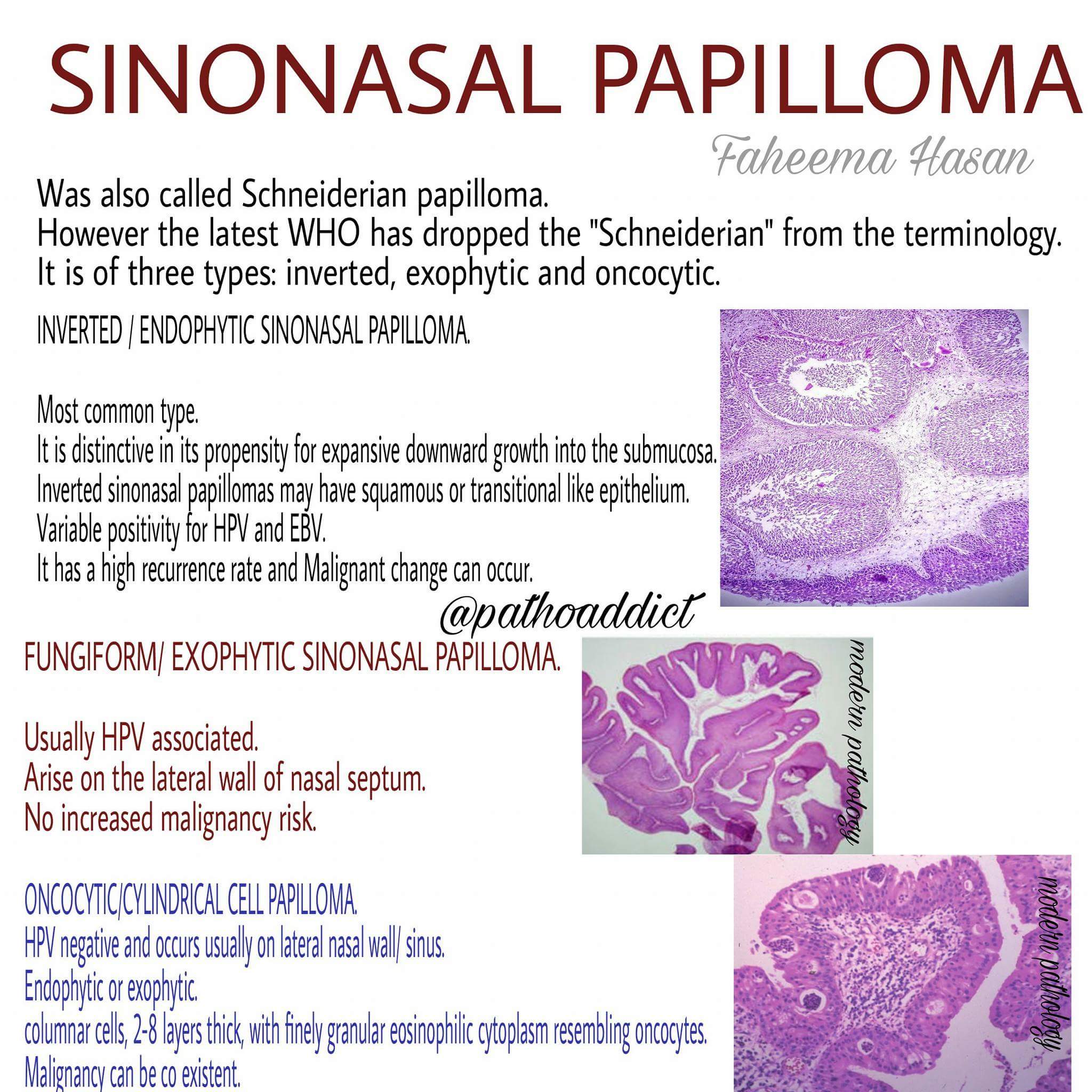 exophytic transitional cell papilloma