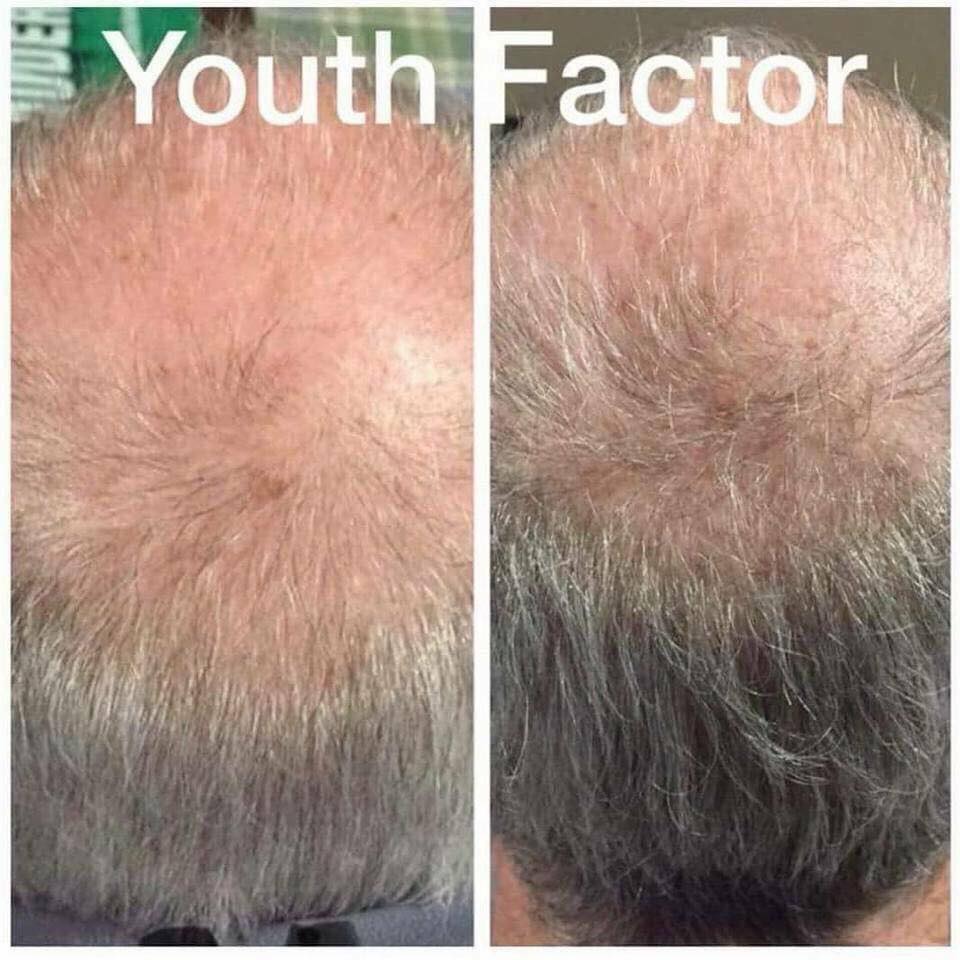 Emma_Lee989's tweet photo. Amazing results with Nerium's Youth factor! 😍 https://t.co/hILsluAjzF
