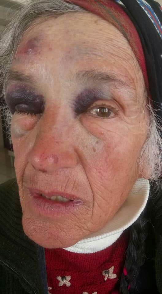 alevsahin81's tweet photo. Perihan Teyze
75 yaşında bir sosyalist. Yaşına, sağlık sorunlarına rağmen direnişin başından beri bizimle sokakta, gözaltında, işkencede.sorulur bu hesap iyi biliyoruz.birseyi daha biliyoruz; iskenceyi seyredip kılını kipirdatmayanlara da tarih çöplüğünde geniş bir yer açar elbet https://t.co/7YLGVysgM9