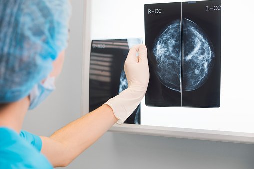 Some women aged between 70 and 79 are being offered the opportunity for a breast screen. This is because some women did not receive an invitation for a final screen, as part of the routine NHS Breast Screening Programme. Find out more here: ow.ly/64qu30jNoUF