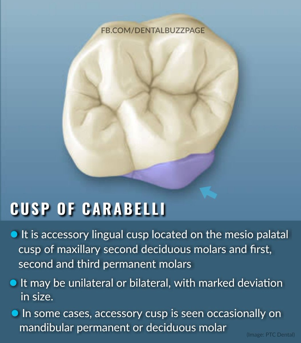 cusp-of-carabelli-mandibular