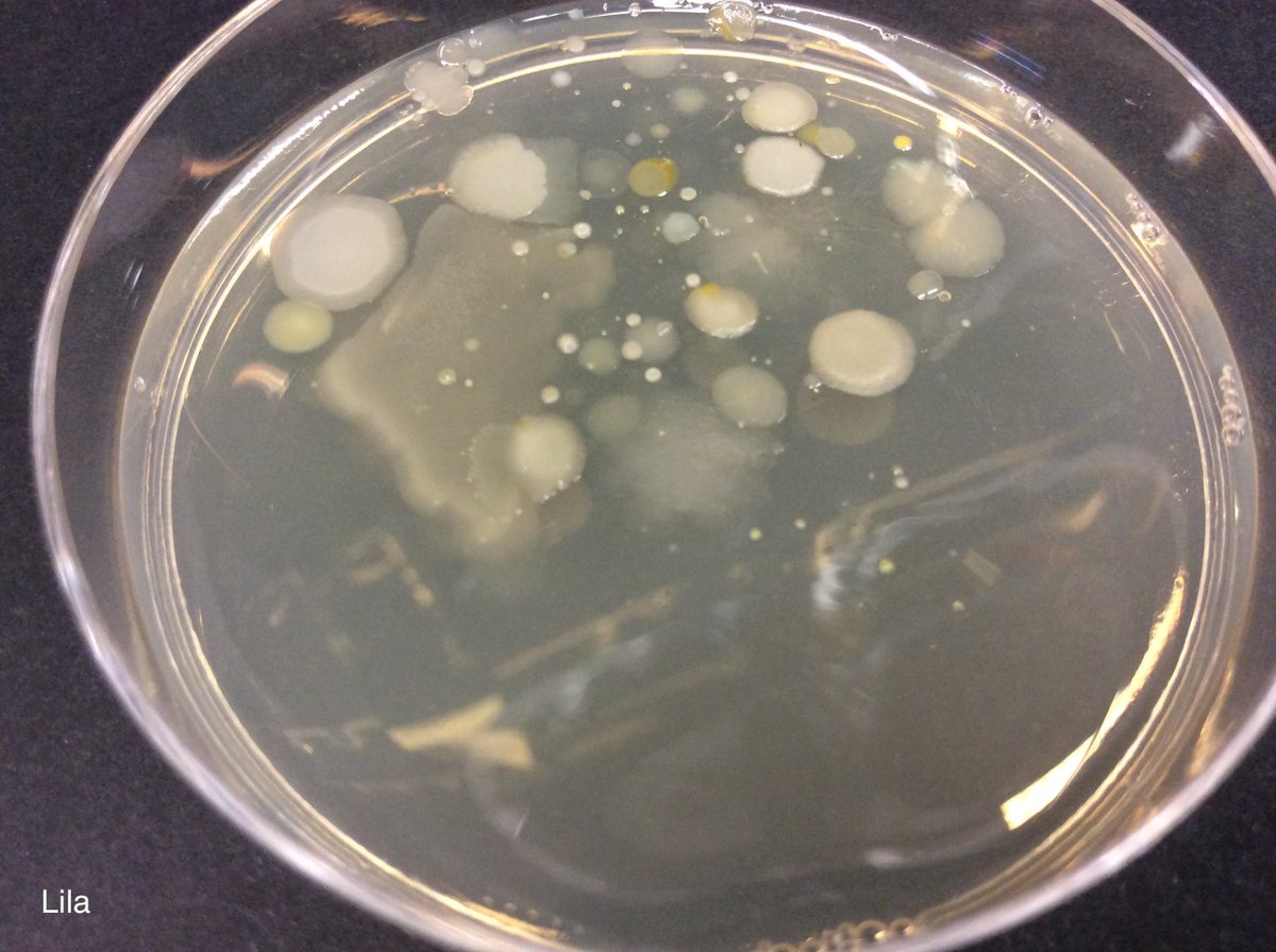 ICLCleverClover's tweet photo. The results of the Clever Clover soil bacteria growth experiments are in!
While we’re uploading all the photos of your amazing plates, here are some of the most exciting ones we've seen from the Saturday group. #ImpFest https://t.co/Op7EHDbvru