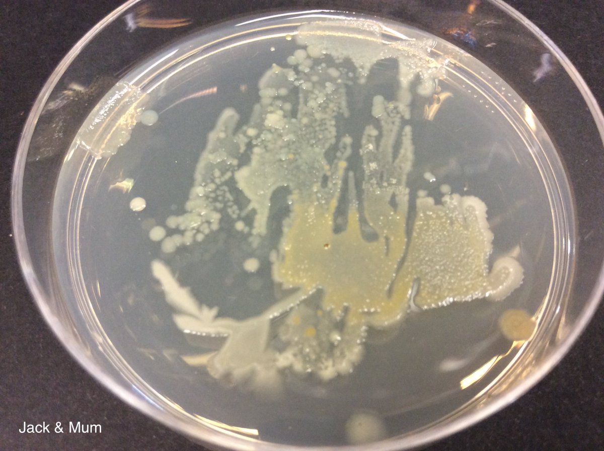 ICLCleverClover's tweet photo. The results of the Clever Clover soil bacteria growth experiments are in!
While we’re uploading all the photos of your amazing plates, here are some of the most exciting ones we've seen from the Saturday group. #ImpFest https://t.co/Op7EHDbvru