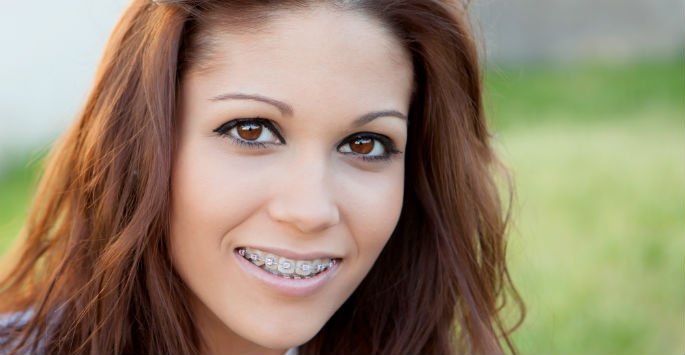 You don't have to be a teen to benefit from #Braces! Call for a #Consultation bit.ly/2Er7QQc