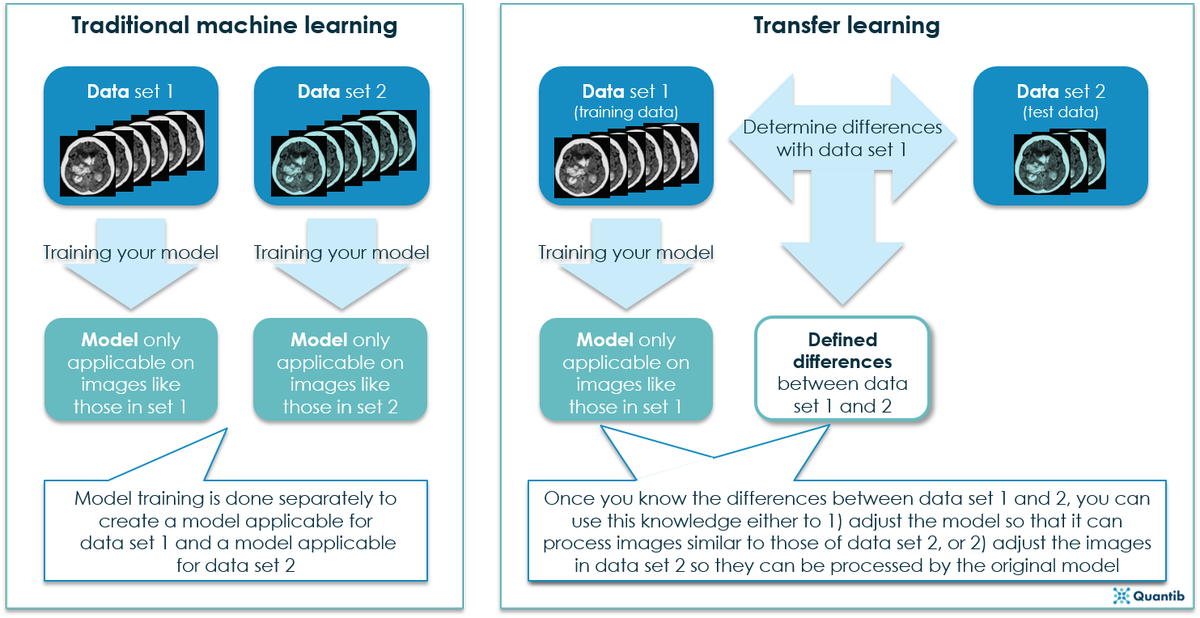 Quantib's tweet photo. One of the big challenges of #artificialintelligence in #radiology is coping with differences between scanners and scan settings. Could #transferlearning be the solution? #Quantib https://t.co/rgwnLhrmgz https://t.co/N6Ul45P7z5
