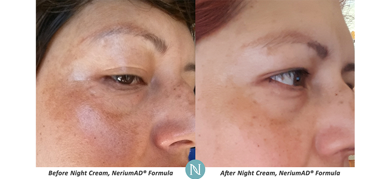 Emma_Lee989's tweet photo. 90 days with Night cream, Ana's results <3 great one step skin care that takes care of discolouration, fine lines, dryness, pigmentation all at once. 🙌🙌 https://t.co/3IVkLXDkl2