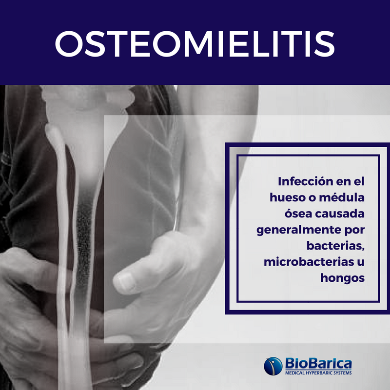 BioBaricaColom1's tweet photo. Las Terapias Hiperbáricas están indicadas para tratar esta Patología. El oxigeno actúa como bactericida ayudando al proceso de recuperación del paciente. 
¡Consúltanos! Nuestros especialistas están listos para resolver tus inquietudes.
Tel: (1) 7044194 Cel. 317 6717724 https://t.co/XzrvNEZFDS
