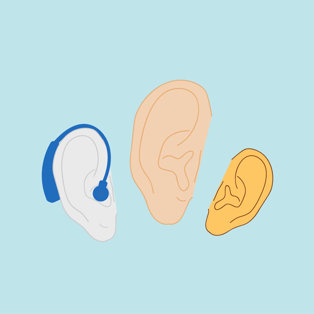 LarryGuterman's tweet photo. Hearing loss is the third most common health problem in the United States. (Source: @NIDCD) If a loved one is in denial about their hearing loss, here are a few suggestions on how to approach the conversation ➡️ https://t.co/HEoGQPRWr2 👂 https://t.co/79yD2mObuq