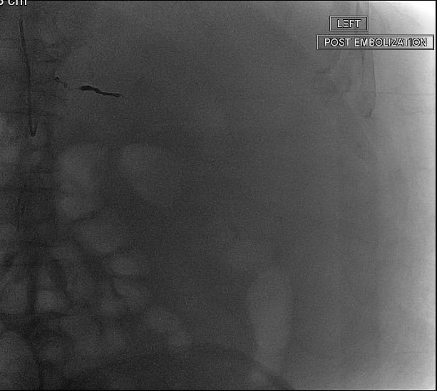 Rochester General Hospital IR tweet media