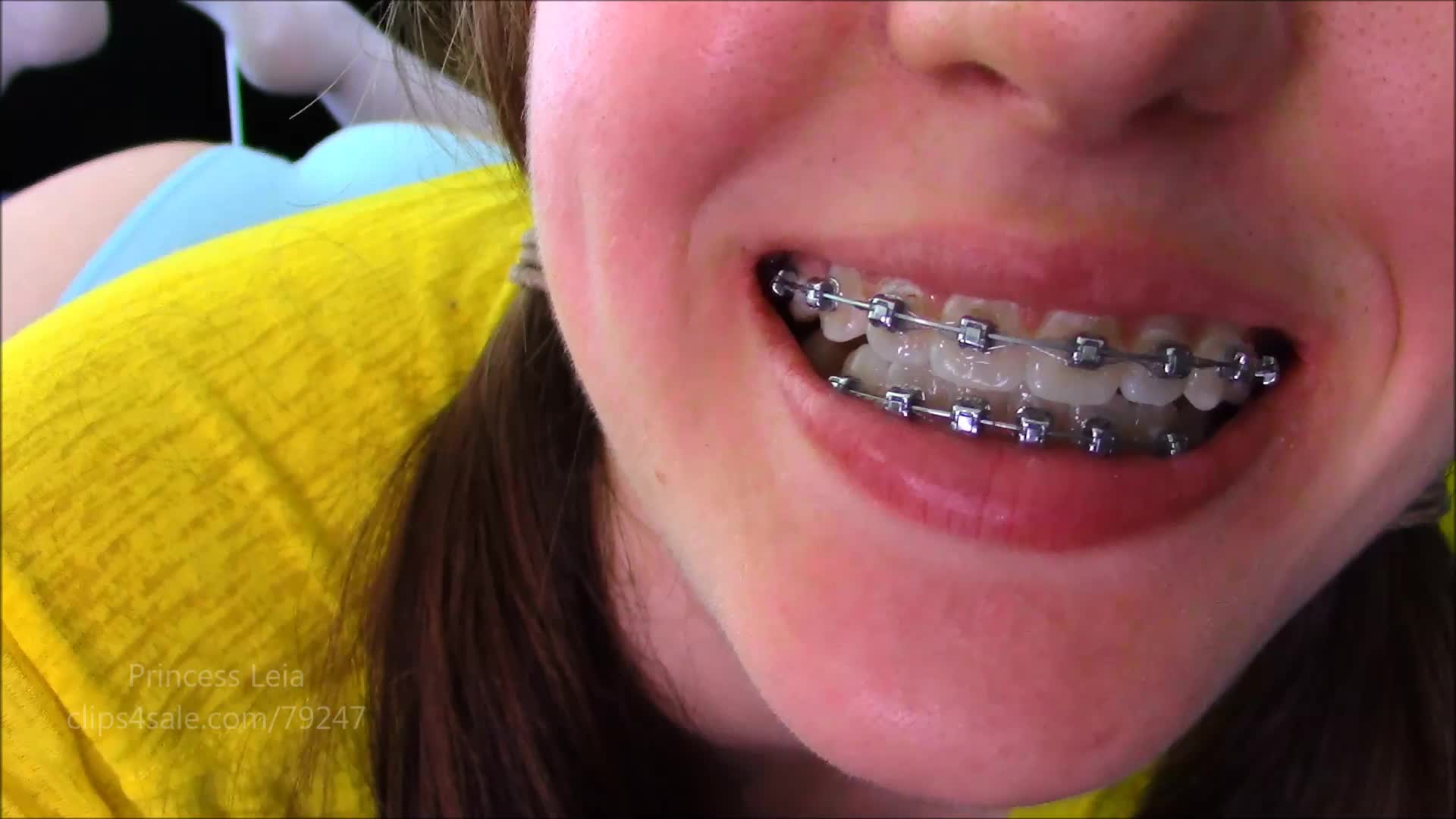 Princess leia braces