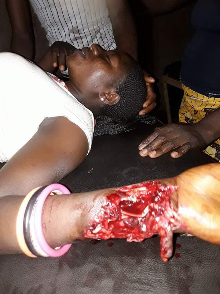 benuemayor01's tweet photo. Passengers from Makurdi to Naka in Benue yesterday evening was attacked by Fulani t who shot at them. One of the passengers  was killed by a bullet hit this young newly married wife who is coming to Naka for the first time to meet her husband's people.
@AishaYesufu @renoomokri https://t.co/S4gFA39cFe