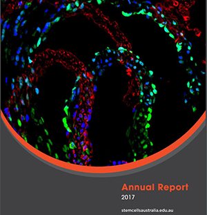@StemCellsAus 2017 Annual Report now available. Download via bit.ly/2JGpDBh to find out more about our discoveries in basic & applied #stemcell biology plus awards, grants & other achievements by our members. Thanks @arc_gov_au for your ongoing support!